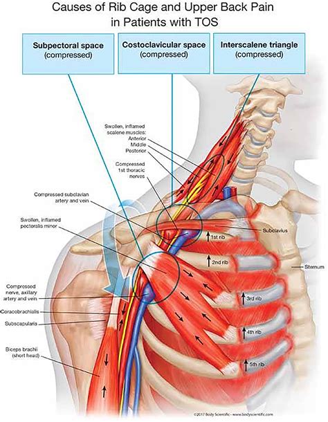 Frontiers | Diagnostic and Therapeutic Management of the Thoracic ...