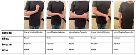 Flexion And Upper Limb Spasticity Stroke