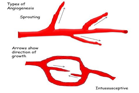 What is Angiogenesis? - Definition & Factors | Study.com