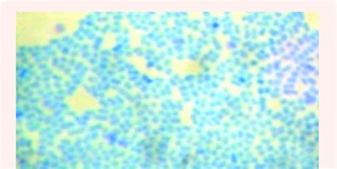 Methylene blue staining. | Download Scientific Diagram