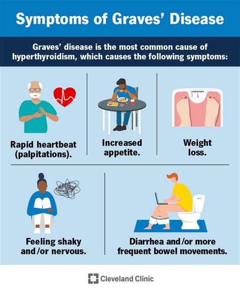 How To Cure Graves Disease - Intelligencesupply16