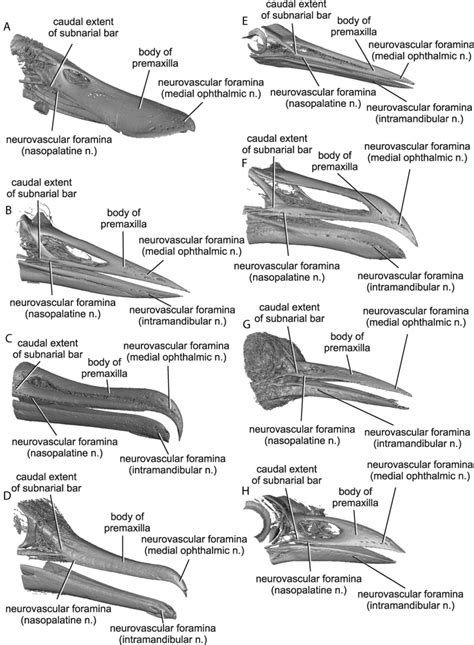 Anatomy of the bony rostrum for individuals portrayed in Figure 2 ...