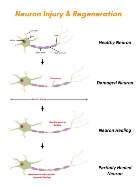 neuron-injury-regeneration-peripheral-nerve-injury-treatment-propel ...