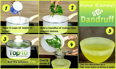 Home Remedies for Dandruff | Top 10 Home Remedies