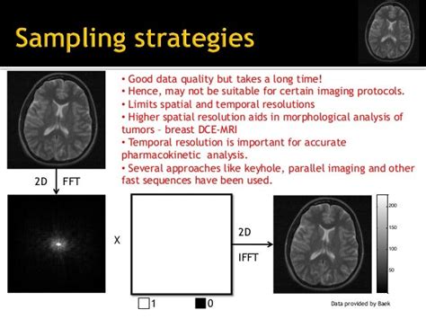 Introduction to compressed sensing MRI