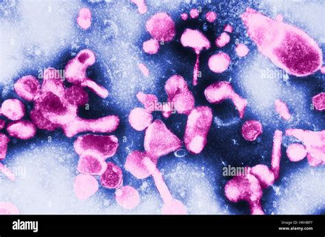 TEM of Feline Leukemia Virus Stock Photo - Alamy