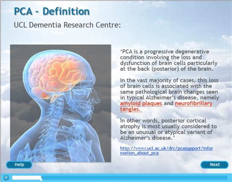 Posterior Cortical Atrophy