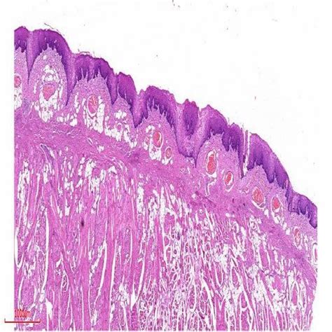 Prepared Microscope Slide Virtual Pathology Slides - Filiform Papillae ...