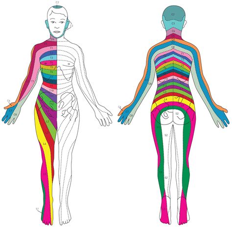 Radiculitis Radicular Pain Causes Symptoms Treatment - Dermatomes Chart ...