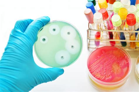 Antibiotic Susceptibility Testing (AST) - Synbiosis