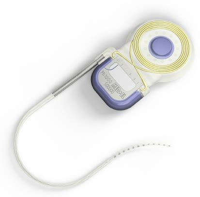 More MED-EL Cochlear Implants Are FDA Cleared for Use with 1.5T MRI ...