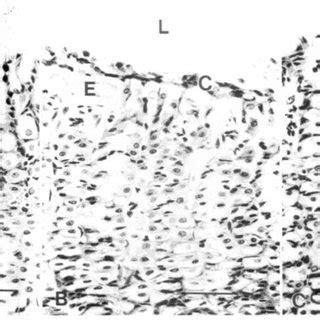 Histology of normal rat gastric foveolae and gastric foveolae showing ...