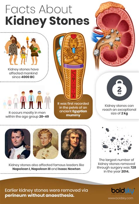 Kidney Stones: Symptoms, Causes, Diagnosis, Treatment And Prevention ...