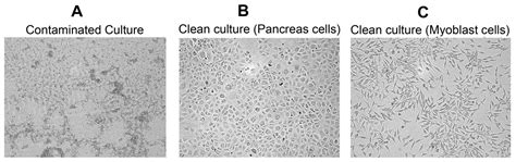 Bacterial Contamination Cell Culture