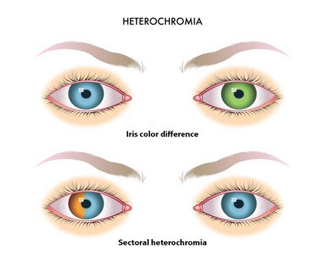 Heterochromia Contacts Prove That Looks Can Deceive — UNIQSO