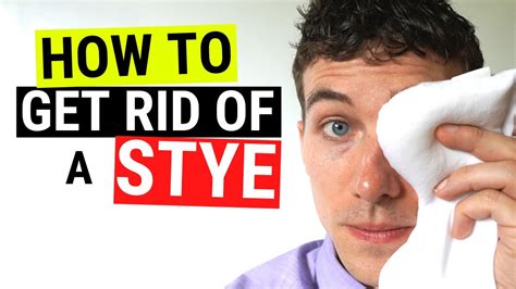 How to Get Rid of a Stye FAST - Chalazion VS Stye Treatment - YouTube