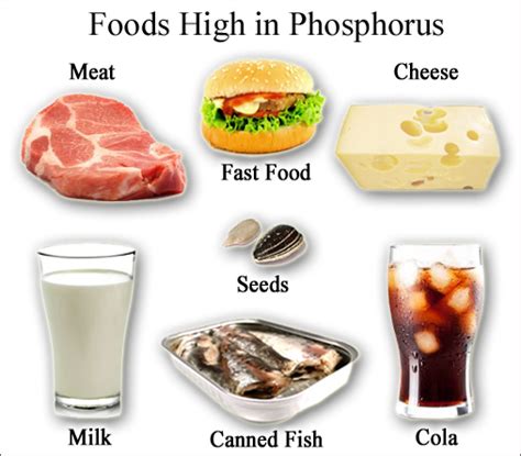 High/Low Phosphorus Foods, Deficiency, Blood Phosphate Levels