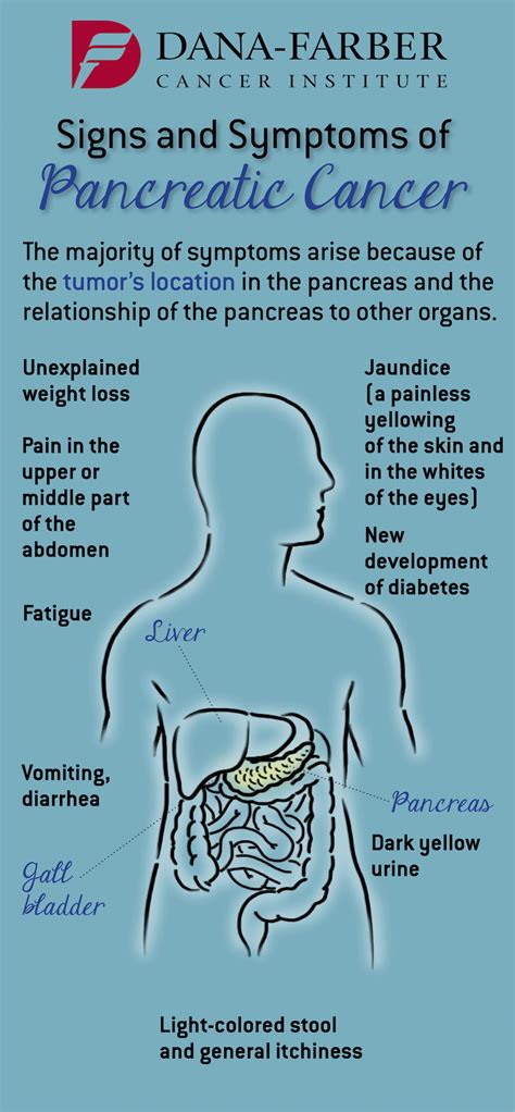 Pancreatic Cancer: What are the Signs and Symptoms? | Dana-Farber ...