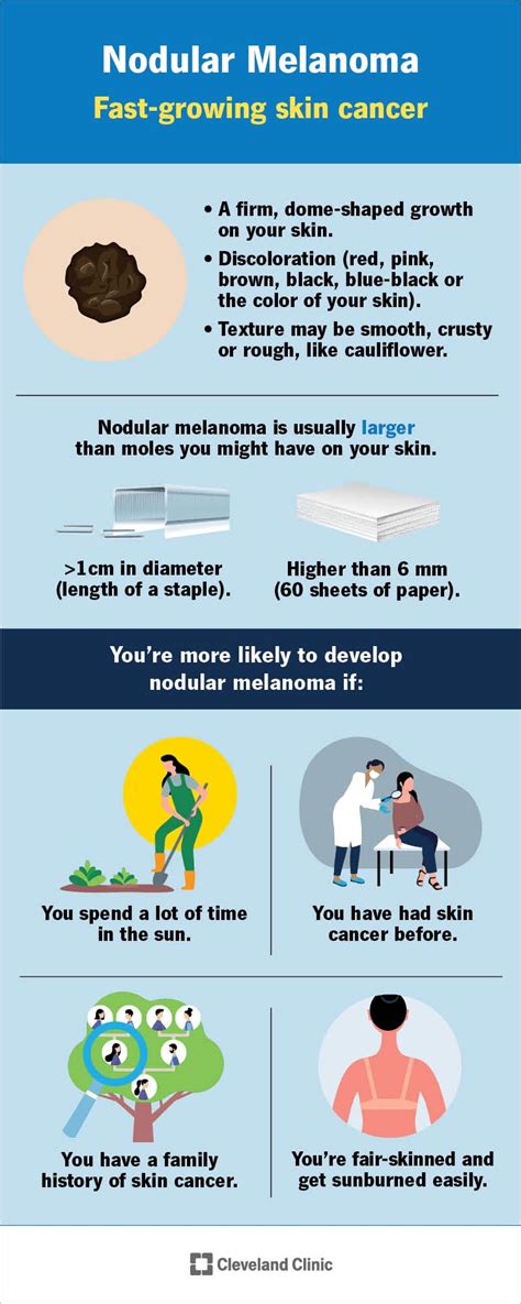 Understanding Melanoma: Causes, Symptoms, And Treatments - Ask The ...