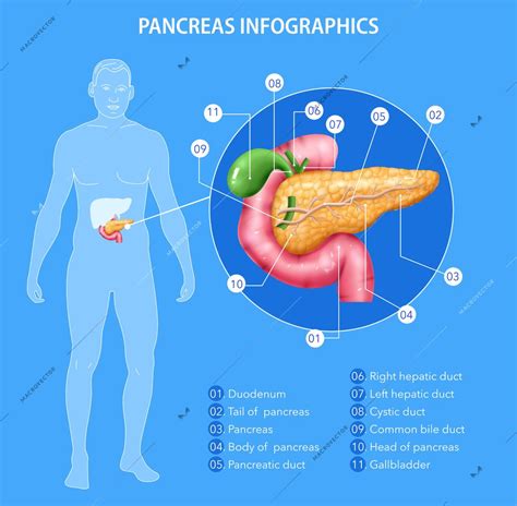 Realistic pancreas anatomy infographics with human body silhouette and ...