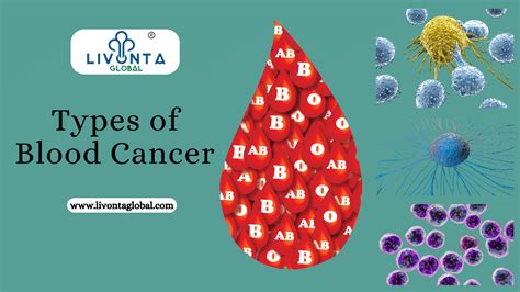 Types of Blood Cancer - Livonta Global Pvt Ltd