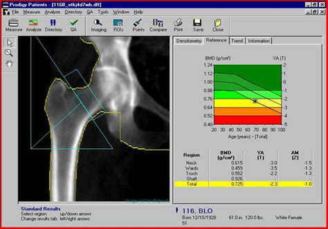 DEXA - Lexington Diagnostic Center