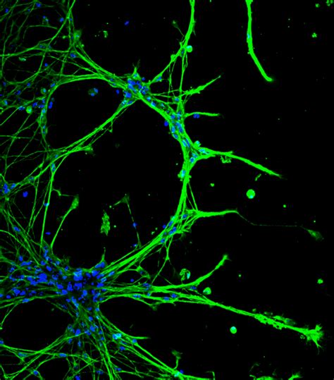 Fluorescence Microscopy (1): What is it? - HCS Pharma