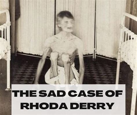 The Sad Case of Rhoda Derry. Rhoda was treated inhumanely for years ...