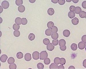 What Should You Know About Parasitic Blood Infection In Cats? - Cat Lovers