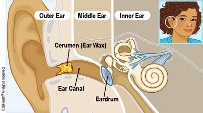 Dealing With Earwax (Cerumen) (for Parents) - Rady Children's Hospital ...