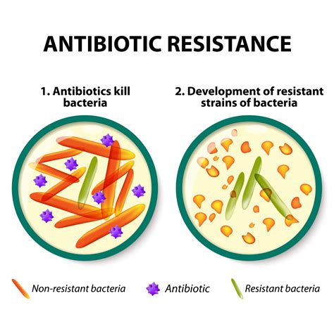 Antibiotic Resistance in Canada | The Canadian Encyclopedia