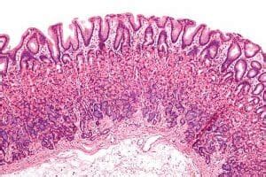 Mucous Membrane (Mucosa) - Definition, Function & Examples