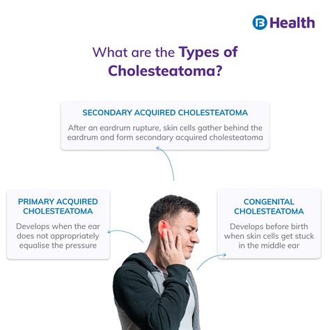 Cholesteatoma: Meaning, Symptoms, Causes, and Type