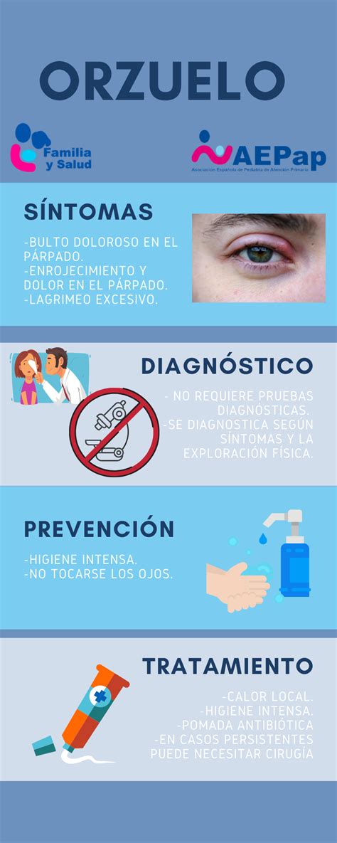 Universal Así llamado receta orzuelo ojo pomada Rebotar diversión paquete