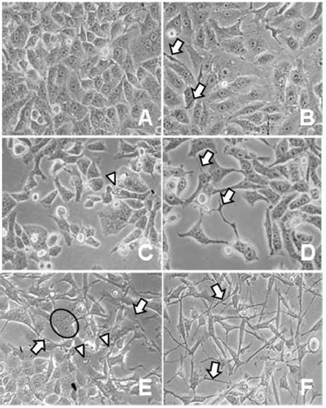 Mycoplasma Contamination In Cell Culture