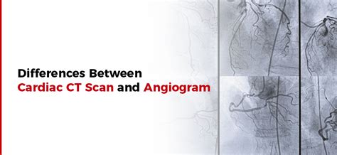 CT Scan or Angiogram - What is the Difference?