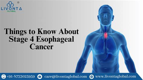 Things to Know About Stage 4 Esophageal Cancer - Livonta Global Pvt Ltd