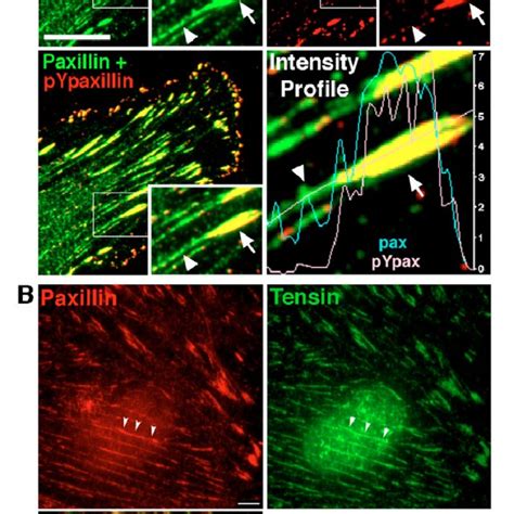 FAK mediates the effect of paxillin phosphorylation on adhesion ...