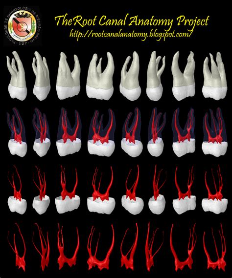 The Root Canal Anatomy Project: Maxillary Second Premolar