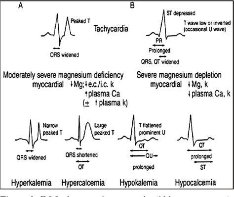 Table 1 from Hypomagnesemia and cardiovascular system. | Semantic Scholar