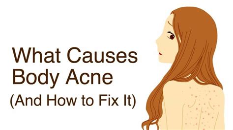 What Causes Body Acne (And How to Fix It)