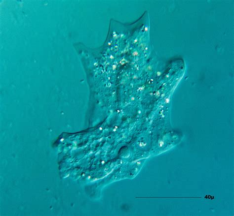 How Does Amoeba Reproduce? - (Reproduction in Amoeba)