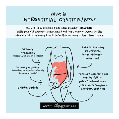 Men and Interstitial Cystitis - The Happy Pelvis