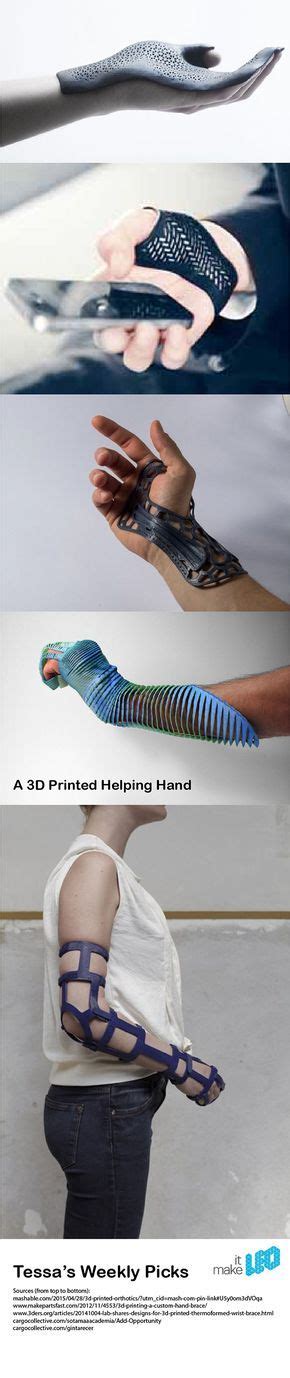 A 3D Printed Helping Hand - 5 Designs of 3D Printed Hand Braces - Tessa ...