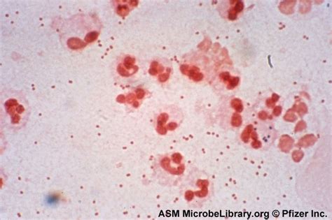 Gram Negative Cocci Microbiology Learning The Why Ology Of 58812 | The ...