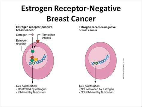 Tamoxifen, Possible Natural Alternatives, and AIs - BREAST CANCER STUDY ...