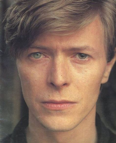 David Bowie has a condition called anisocoria, which is the medical ...