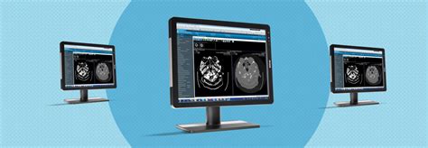 Barco Monitor: DICOM Compatible Medical Image Viewer Review - HealthTech