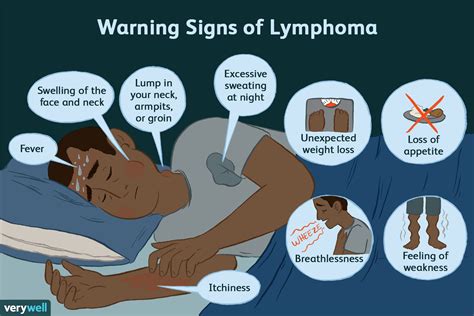 Lymphoma: Signs, Symptoms, and Complications | Lymphoma, Lymphoma ...