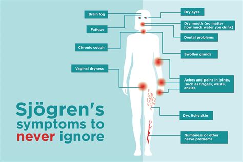 Sjögren’s Symptoms You Might Be Ignoring